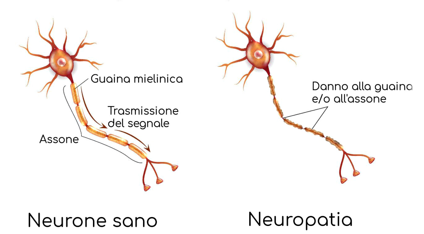 danno neuronale